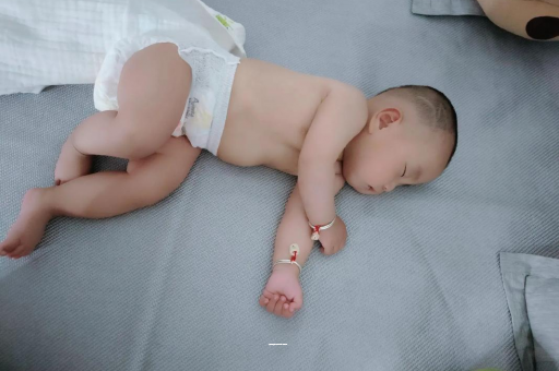 伊犁哈萨克宝宝上火有眼屎